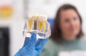 Implantes dentales en l'Eixample Barcelona