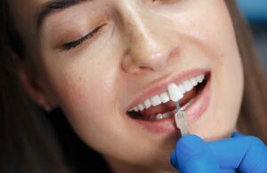 tipos-de-carillas-dentales